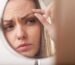 Eyebrow hair loss